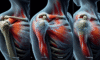 Acupuncture for Effective Relief from Frozen Shoulder