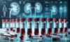 Kidney Blood Test Guide for Residents in Blackburn