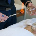 Cupping Therapy: Unlock Healing Benefits in Melbourne