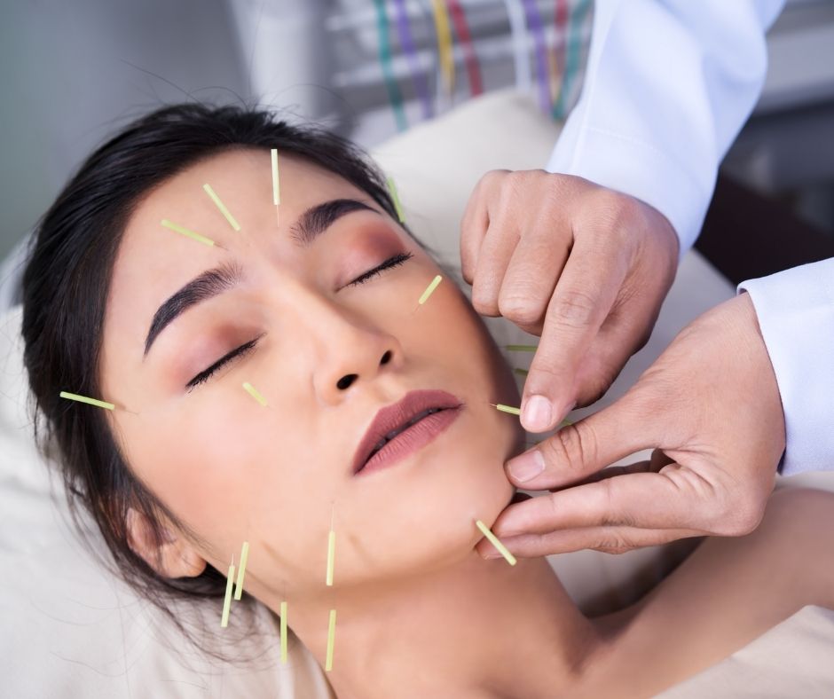 Cosmetic Acupuncture: Important Drawbacks to Be Aware Of